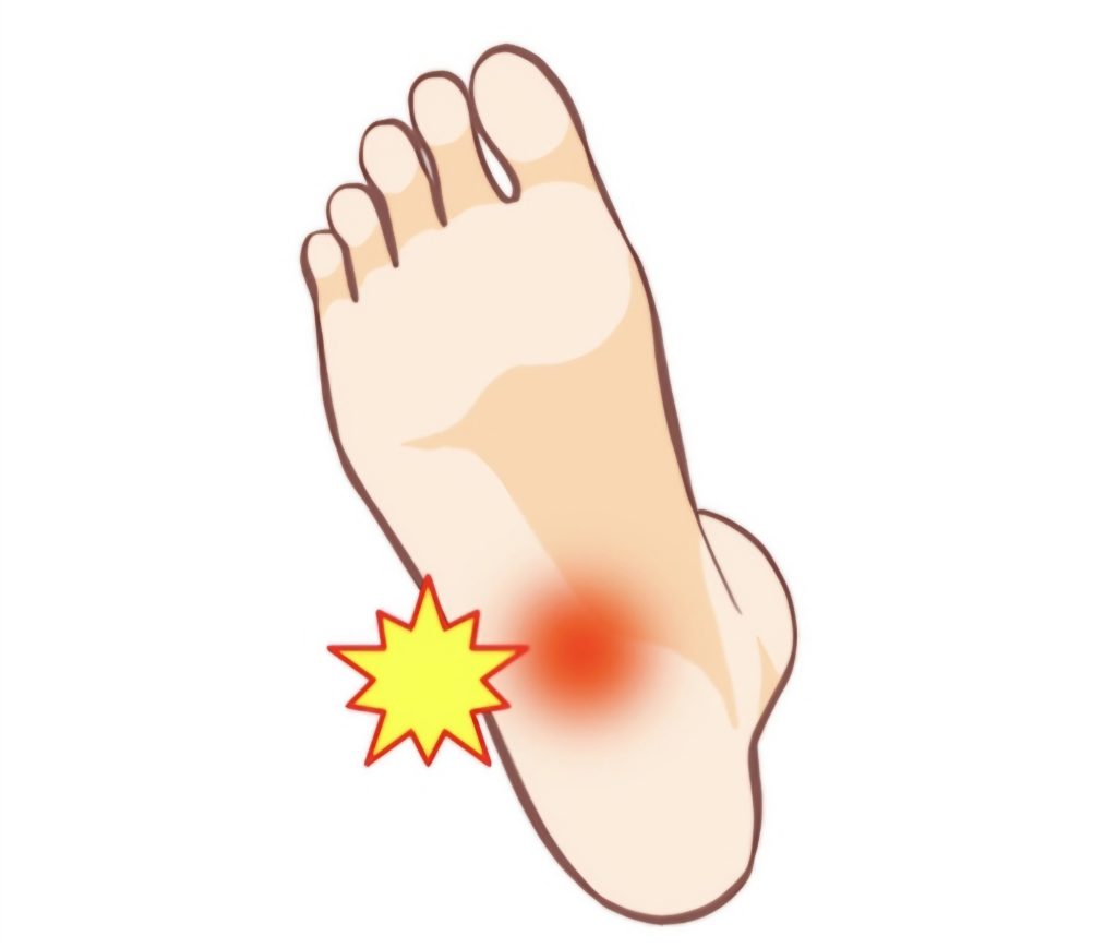 土踏まずが痛い・踵の後ろが痛い