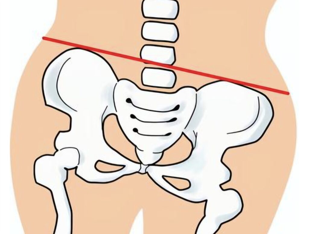 産後の骨盤矯正の重要性