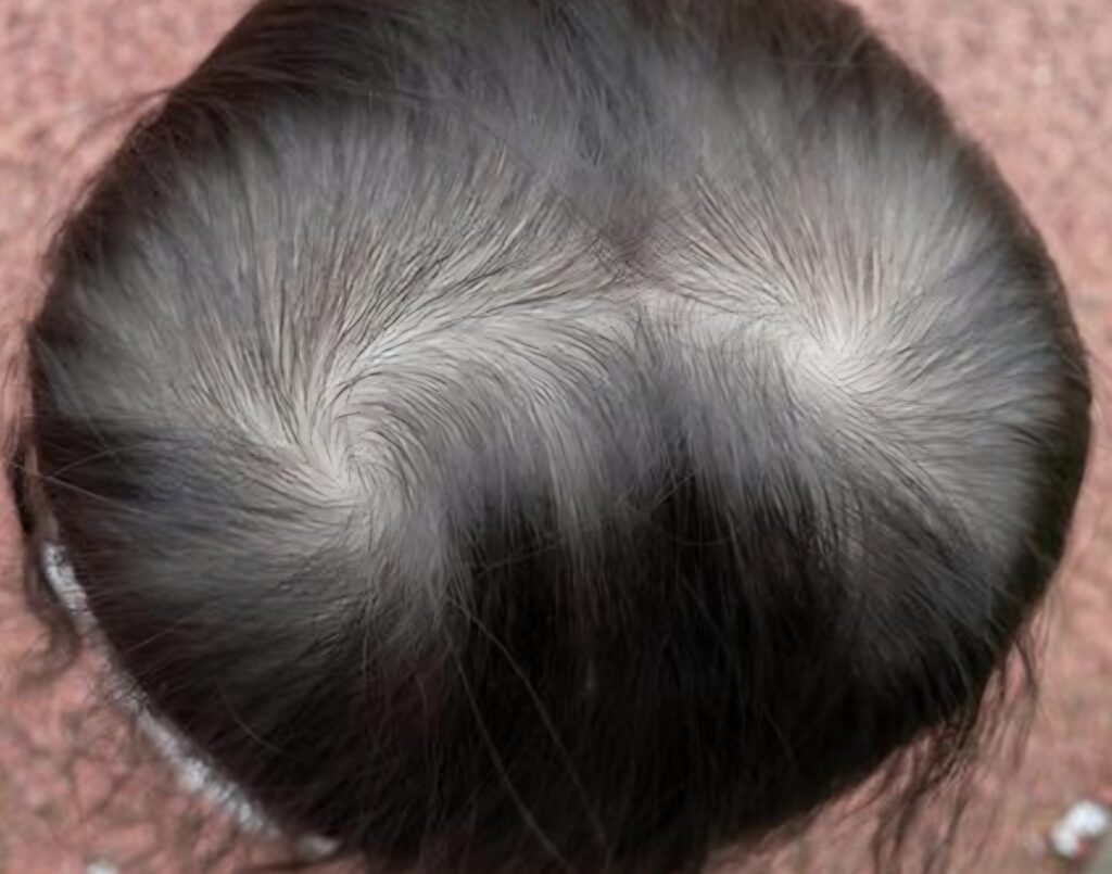 赤ちゃんの頭の形整体・赤ちゃん整体