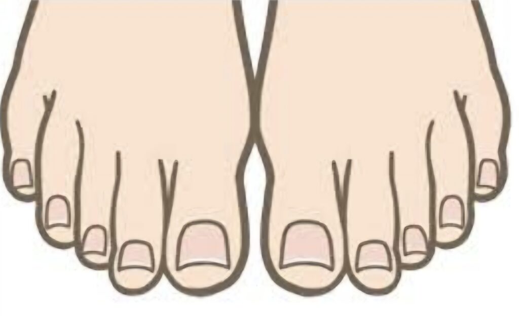 巻き爪の原因ってなに？